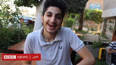 Photo of شاب مصري يقول إنه رفض من كلية التربية الرياضية بسبب شفته