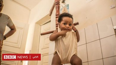 Photo of فيروس كورونا: الكونغو الديمقراطية تواجه مخاطر تفشي الحصبة بين الأطفال بسبب كوفيد